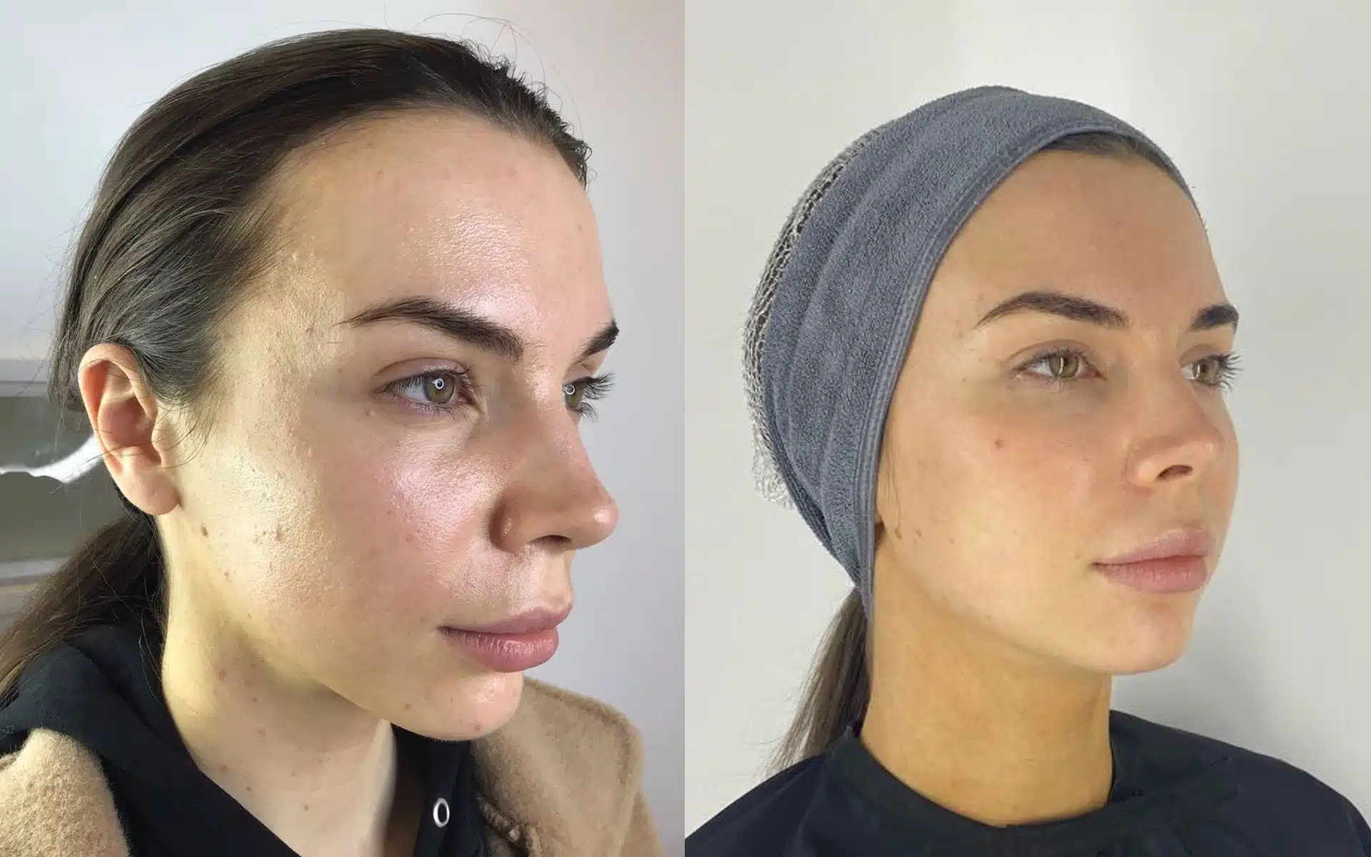 Skin concerns Oily Skin