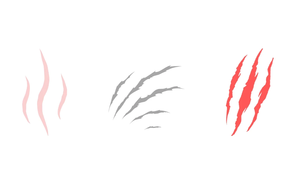 types of stretch marks