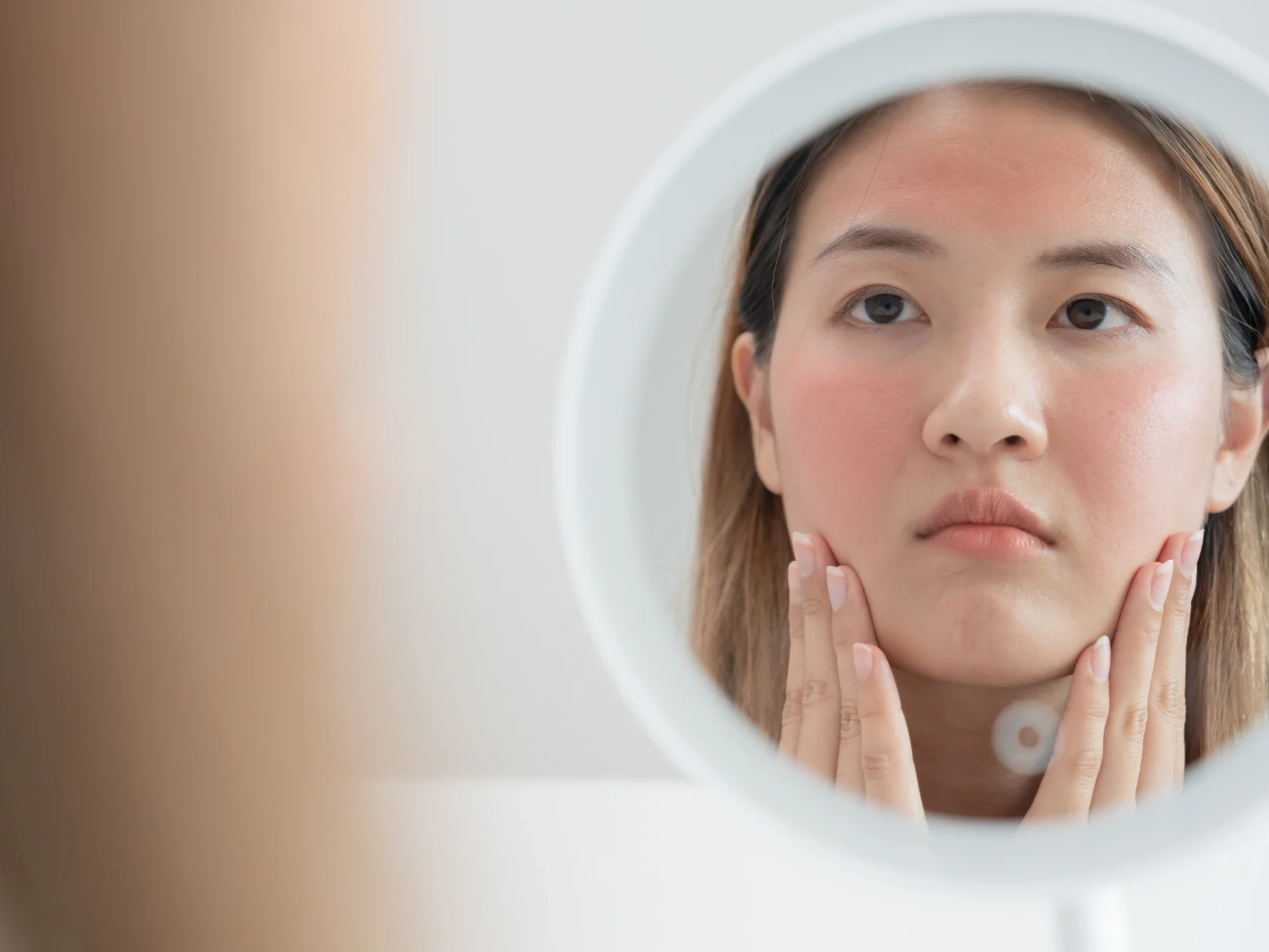 ROSACEA FTT SKIN CLINICS