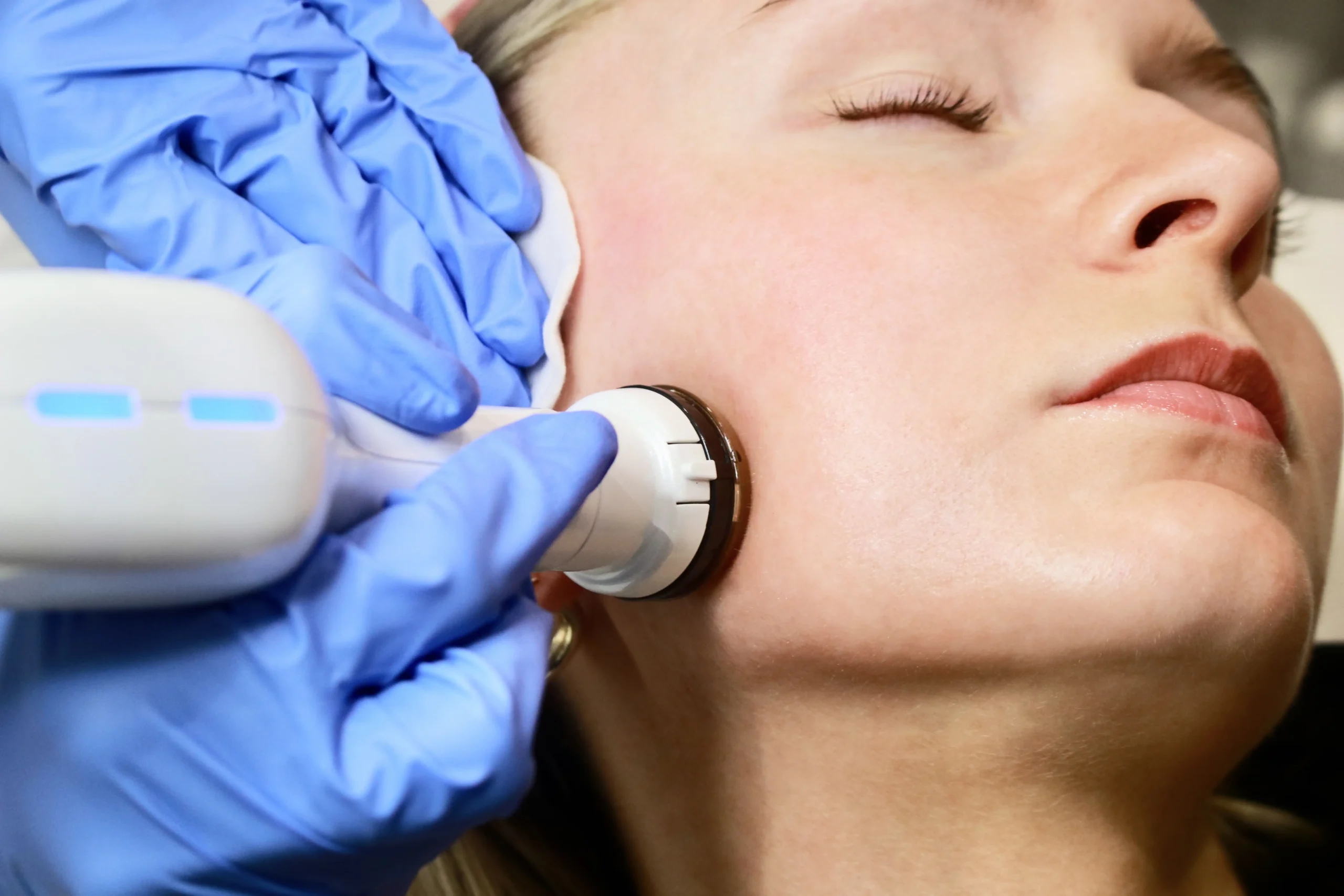 plasma shower skin concerns treatments